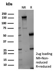 SDS-PAGE Analysis of Purified AKR1C1 Mouse Monoclonal Antibody (AKR1C1/9069). Confirmation of Purity and Integrity of Antibody.