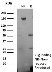 SDS-PAGE Analysis of Purified Desmin Recombinant Mouse Monoclonal Antibody (rDES/8846). Confirmation of Purity and Integrity of Antibody.
