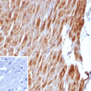 Formalin-fixed, paraffin-embedded human heart muscle stained with Desmin Rabbit Recombinant Monoclonal Antibody (DES/8610R). Inset: PBS instead of primary antibody; secondary only negative control.