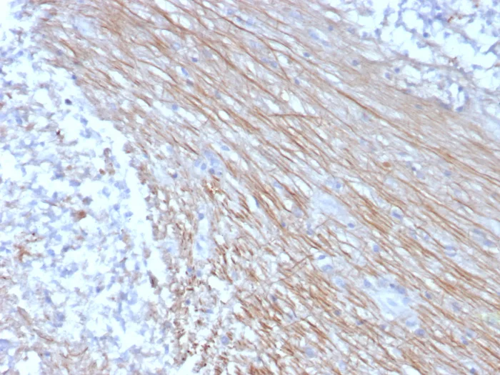 Formalin-fixed, paraffin-embedded human placenta stained with CD303 / CLEC4C Mouse Monoclonal Antibody (CLEC4C/3400). HIER: Tris/EDTA, pH9.0, 45min. 2°C: HRP-polymer, 30min. DAB, 5min. CLEC4C Antibody in Immunohistochemistry (IHC (P))