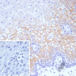 Formalin-fixed, paraffin-embedded human esophagus stained with Desmocollin-2/3 Recombinant Rabbit Monoclonal Antibody (DSC2/9165R). Inset: PBS instead of primary antibody; secondary only negative control.