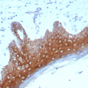 Formalin-fixed, paraffin-embedded human skin stained with Desmoglein-1 Recombinant Rabbit Monoclonal Antibody (DSG1/8576R).
