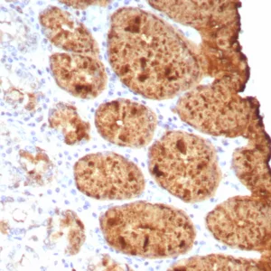 Formalin-fixed, paraffin-embedded human colon stained with TAG-72 Recombinant Mouse Monoclonal Antibody (rTAG72/9132). HIER: Tris/EDTA, pH9.0, 45min. 2°C: HRP-polymer, 30min. DAB, 5min.