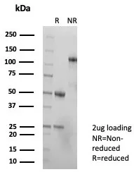 SDS-PAGE Analysis of Purified TAG-72 Rabbit Recombinant Monoclonal Antibody (TAG72/8317R). Confirmation of Purity and Integrity of Antibody.