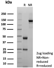 SDS-PAGE Analysis of Purified Desmoglein-3 Recombinant Mouse Monoclonal Antibody (rDSG3/8612). Confirmation of Integrity and Purity of Antibody.