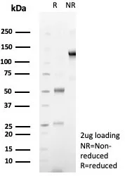 SDS-PAGE Analysis of Purified DSG3 Recombinant Rabbit Monoclonal Antibody (DSG3/8251R). Confirmation of Integrity and Purity of Antibody.