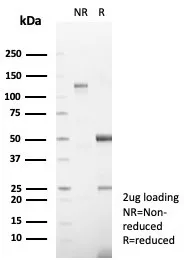 SDS-PAGE Analysis of Purified DSG3 Recombinant Rabbit Monoclonal Antibody (DSG3/8252R). Confirmation of Integrity and Purity of Antibody.