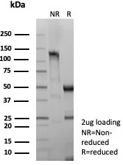 SDS-PAGE Analysis of Purified DSG3 Recombinant Rabbit Monoclonal Antibody (DSG3/8613R). Confirmation of Integrity and Purity of Antibody.