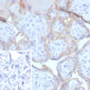 Formalin-fixed, paraffin-embedded human placenta stained with EGFR Mouse Monoclonal Antibody (EGFR/4616). Inset: PBS instead of primary antibody; secondary only negative control.