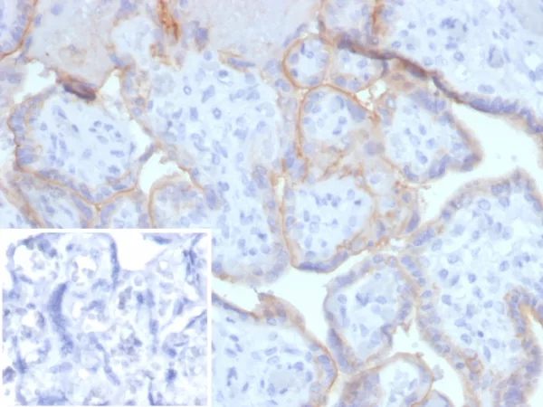 Formalin-fixed, paraffin-embedded human placenta stained with EGFR Mouse Monoclonal Antibody (EGFR/4616). Inset: PBS instead of primary antibody; secondary only negative control.