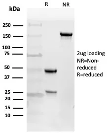 SDS-PAGE Analysis of Purified EGFR Mouse Monoclonal Antibody (225). Confirmation of Purity and Integrity of Antibody.