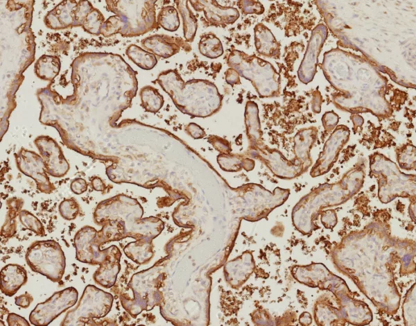 Formalin-fixed, paraffin-embedded human placenta stained with EGFR Recombinant Rabbit Monoclonal Antibody (EGFR/9166R). HIER: Tris/EDTA, pH9.0, 45min. 2°C: HRP-polymer, 30min. DAB, 5min.