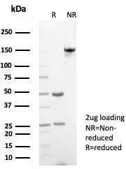 SDS-PAGE Analysis of Purified Alpha-2-Macroglobulin Mouse Monoclonal Antibody (A2M/6550). Confirmation of Purity and Integrity of Antibody.