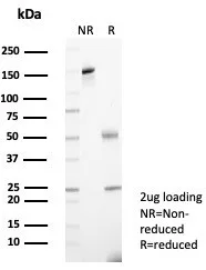 SDS-PAGE Analysis of Purified Alpha-2-Macroglobulin Mouse Monoclonal Antibody (A2M/6555). Confirmation of Purity and Integrity of Antibody.