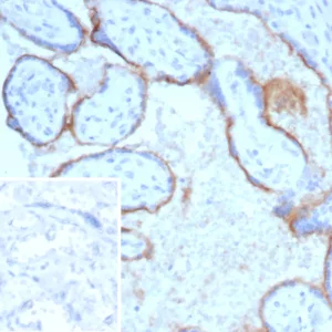Formalin-fixed, paraffin-embedded human placenta stained with Endoglin / CD105 Mouse Monoclonal Antibody (ENG/4750) Inset: PBS instead of primary antibody; secondary only negative control.