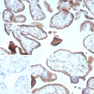 Formalin-fixed, paraffin-embedded human placenta stained with Endoglin / CD105 Recombinant Rabbit Monoclonal Antibody (ENG/8961R) Inset: PBS instead of primary antibody; secondary only negative control.