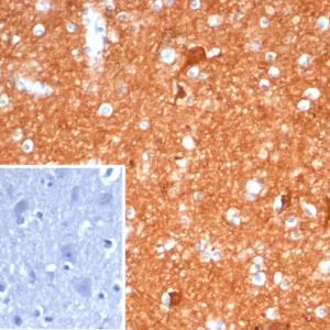 Formalin-fixed, paraffin-embedded human brain stained with NSE gamma Mouse Monoclonal Antibody (ENO2/6680). Inset: PBS instead of primary antibody; secondary only negative control.