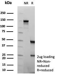 SDS-PAGE Analysis of Purified NSE gamma Recombinant Mouse Monoclonal Antibody (rENO/8684). Confirmation of Purity and Integrity of Antibody.