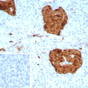 Formalin-fixed, paraffin-embedded human pancreas stained with NSE gamma Mouse Monoclonal Antibody (ENO2/9046). Inset: PBS instead of primary antibody; secondary only negative control.