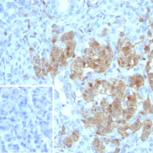 Formalin-fixed, paraffin-embedded human pancreas stained with NSE gamma Recombinant Rabbit Monoclonal Antibody (ENO/8253R). Inset: PBS instead of primary antibody; secondary only negative control.