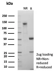 SDS-PAGE Analysis of Purified NSE gamma Recombinant Rabbit Monoclonal Antibody (ENO/8632R). Confirmation of Purity and Integrity of Antibody.