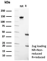 SDS-PAGE Analysis of Purified Tubulin beta 3 Mouse Monoclonal Antibody (TUBB/4470). Confirmation of Purity and Integrity of Antibody.