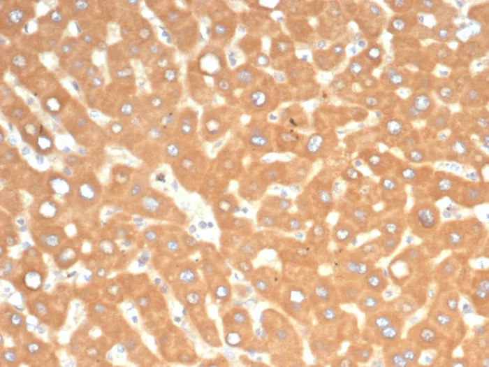 Formalin-fixed, paraffin-embedded human liver in colon stained with EPH Receptor B4 (EPHB4) Mouse Monoclonal Antibody (EPHB4/6391). HIER: Tris/EDTA, pH9.0, 45min. 2°C: HRP-polymer, 30min. DAB, 5min. EPH Receptor B4 (EPHB4) Antibody - Image 2