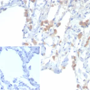 Formalin-fixed, paraffin-embedded human lung stained with EPH Receptor B4 (EPHB4) Mouse Monoclonal Antibody (EPHB4/6392). Inset: PBS instead of primary antibody; secondary only negative control.