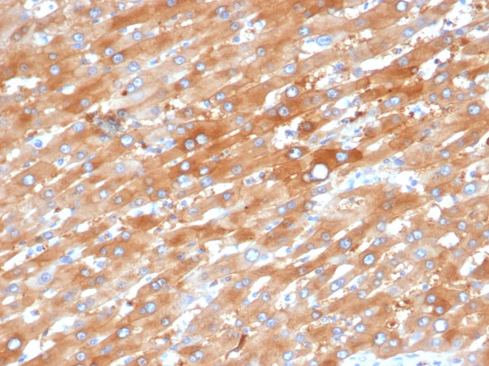 Formalin-fixed, paraffin-embedded human liver in colon stained with EPH Receptor B4 (EPHB4) Mouse Monoclonal Antibody (EPHB4/6392). HIER: Tris/EDTA, pH9.0, 45min. 2°C: HRP-polymer, 30min. DAB, 5min. EPH Receptor B4 (EPHB4) Antibody - Image 2