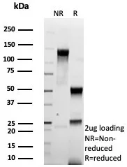 SDS-PAGE Analysis of Purified HER2 Recombinant Mouse Monoclonal Antibody (rERBB2/9401). Confirmation of Purity and Integrity of Antibody.