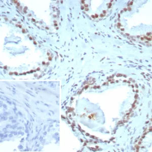 Formalin-fixed, paraffin-embedded human prostate stained with  ERCC1 Mouse Monoclonal Antibody (ERCC1/7596). Inset: PBS instead of primary antibody; secondary only negative control.