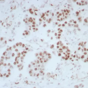 Formalin-fixed, paraffin-embedded human bladder stained with  ERCC1 Mouse Monoclonal Antibody (ERCC1/7597). HIER: Tris/EDTA, pH9.0, 45min. 2°C: HRP-polymer, 30min. DAB, 5min.