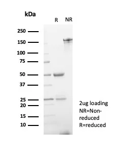SDS-PAGE Analysis of Purified ERG Mouse Monoclonal Antibody (ERG/6980). Confirmation of Purity and Integrity of Antibody.