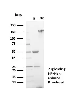 SDS-PAGE Analysis of Purified ERG Mouse Monoclonal Antibody (ERG/6980). Confirmation of Purity and Integrity of Antibody. ERG Antibody in SDS-PAGE