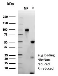 SDS-PAGE Analysis of Purified ERG Recombinant Rabbit Monoclonal Antibody (ERG/9122R).  Confirmation of Purity and Integrity of Antibody.