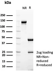 SDS-PAGE Analysis of Purified ESR1 Recombinant Rabbit Monoclonal Antibody (ESR1/8206). Confirmation of Purity and Integrity of Antibody.