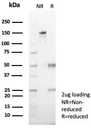 SDS-PAGE Analysis of Purified EZH2 / KMT6 Mouse Monoclonal Antibody (EZH2/7507). Confirmation of Purity and Integrity of Antibody. EZH2 / KMT6 Antibody - Image 2