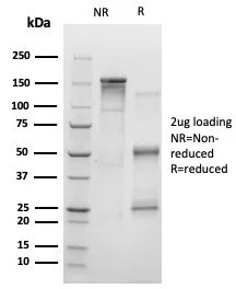 SDS-PAGE Analysis of Purified EZH2 / KMT6 Mouse Monoclonal Antibody (EZH2/4194). Confirmation of Purity and Integrity of Antibody.