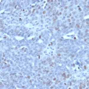 Formalin-fixed, paraffin-embedded human tonsil stained with EZH2 / KMT6 Mouse Monoclonal Antibody (EZH2/6989). HIER: Tris/EDTA, pH9.0, 45min. 2°C: HRP-polymer, 30min. DAB, 5min.