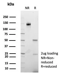 SDS-PAGE Analysis  Purified Coagulation Factor VII Mouse Monoclonal Antibody (F7/4931). Confirmation of Integrity and Purity of Antibody.