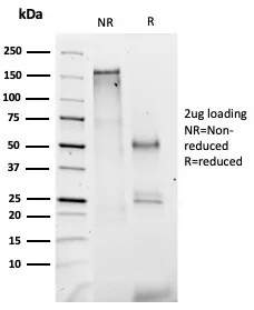 SDS-PAGE Analysis  Purified Coagulation Factor VII Mouse Monoclonal Antibody (F7/3512). Confirmation of Integrity and Purity of Antibody.