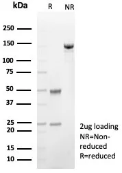 SDS-PAGE Analysis of Purified FABP4 Recombinant Mouse Monoclonal Antibody (rFABP4/8536). Confirmation of Purity and Integrity of Antibody.