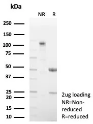 SDS-PAGE Analysis of Purified FABP4 Recombinant Rabbit Monoclonal Antibody (FABP4/8537R). Confirmation of Purity and Integrity of Antibody.