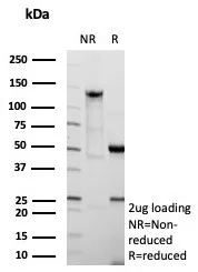 SDS-PAGE Analysis of Purified FABP4 Recombinant Rabbit Monoclonal Antibody (FABP4/9086R). Confirmation of Purity and Integrity of Antibody.