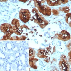 Formalin-fixed, paraffin-embedded human kidney stained with FABP1 Recombinant Mouse Monoclonal Antibody (rFABP1/8520). Inset: PBS instead of primary antibody; secondary only negative control.