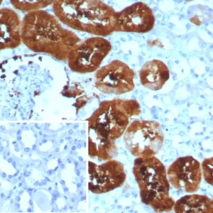 Formalin-fixed, paraffin-embedded human kidney stained with FABP1 Recombinant Rabbit Monoclonal Antibody (FABP1/8521R). Inset: PBS instead of primary antibody; secondary only negative control.
