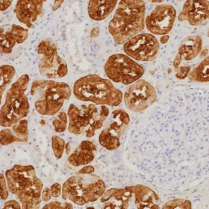 Formalin-fixed, paraffin-embedded human kidney stained with FABP1 Recombinant Rabbit Monoclonal Antibody (FABP1/9085R). Inset: PBS instead of primary antibody; secondary only negative control.