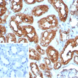Formalin-fixed, paraffin-embedded human heart stained with FABP3 Recombinant Rabbit Monoclonal Antibody (FABP3/8535R). HIER: Tris/EDTA, pH9.0, 45min. 2°C: HRP-polymer, 30min. DAB, 5min.