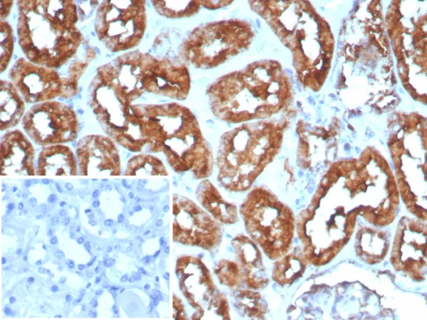 Formalin-fixed, paraffin-embedded human heart stained with FABP3 Recombinant Rabbit Monoclonal Antibody (FABP3/8535R). HIER: Tris/EDTA, pH9.0, 45min. 2°C: HRP-polymer, 30min. DAB, 5min.