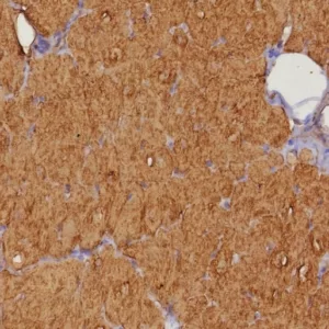 Formalin-fixed, paraffin-embedded human heart stained with FABP3 Recombinant Rabbit Monoclonal Antibody (FABP3/8343R). HIER: Tris/EDTA, pH9.0, 45min. 2: HRP-polymer, 30min. DAB, 5min.